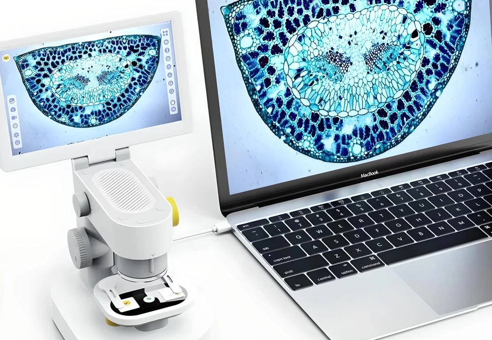 best digital microscope with screen